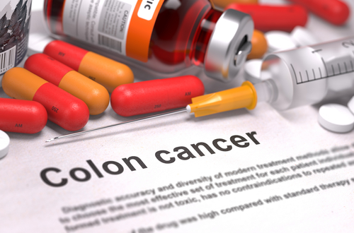 know about colon cancer