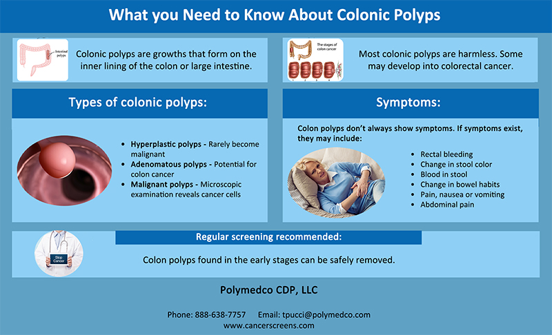 Know About Colonic Polyps
