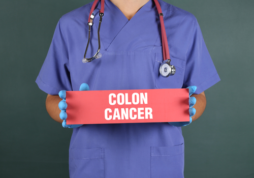 FIT Test for Colon Cancer